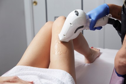 Laser hair removal sessiones