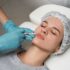 lip fillers
