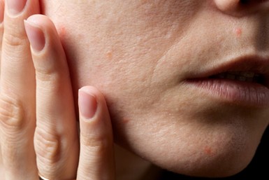 facial for dry skin 2